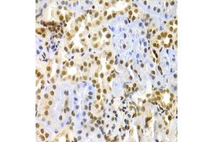 Immunohistochemistry of paraffin-embedded rat kidney using MAPK3 Antibody. (ERK1 抗体)