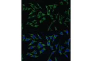Immunofluorescence analysis of L929 cells using P Polyclonal Antibody (ABIN7269446) at dilution of 1:100 (40x lens). (PABP 抗体  (AA 350-450))