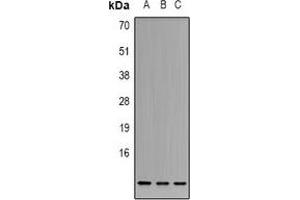 Western blot analysis of Cystatin A expression in K562 (A), HT29 (B), A549 (C) whole cell lysates. (CSTA 抗体)