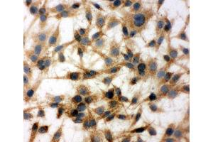 Immunohistochemistry (IHC) image for anti-Cytochrome C Oxidase Subunit I (COX1) (AA 2-14), (N-Term) antibody (ABIN3042632)