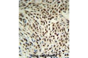 Immunohistochemistry (IHC) image for anti-Small Nuclear Ribonucleoprotein D3 Polypeptide 18kDa (SNRPD3) antibody (ABIN3004111) (SNRPD3 抗体)