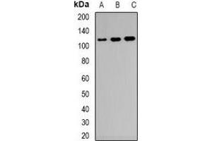 Western blot analysis of CD21 expression in Raji (A), KB (B), NIH3T3 (C) whole cell lysates. (CD21 抗体)