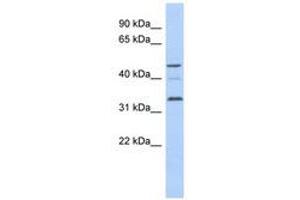 Image no. 1 for anti-Cyclin Y-Like 1 (CCNYL1) (AA 71-120) antibody (ABIN6741212) (CCNYL1 抗体  (AA 71-120))