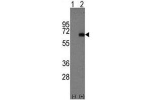 Western blot analysis of AFP antibody and 293 cell lysate either nontransfected (Lane 1) or transiently transfected with the AFP gene (2).