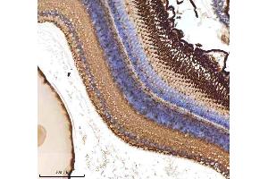 IHC analysis of ATOH7 using anti-ATOH7 antibody (AZQ8AW52).