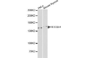 Western blot analysis of extracts of various cell lines, using RECQL4 antibody (ABIN2564922) at 1:1000 dilution. (RECQL4 抗体)