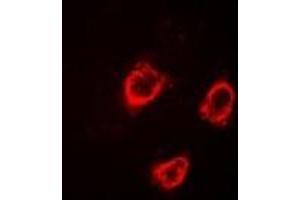 Immunofluorescence (IF) image for anti-Transient Receptor Potential Cation Channel, Subfamily V, Member 5 (TRPV5) antibody (ABIN7308444)