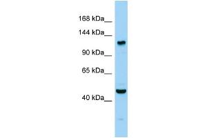 Host: Rabbit Target Name: Agtpbp1 Sample Type: Mouse Testis lysates Antibody Dilution: 1. (AGTPBP1 抗体  (C-Term))