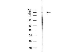anti-Eukaryotic Translation Initiation Factor 2-alpha Kinase 3 (EIF2AK3) (pThr982) antibody