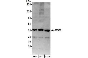 anti-Replication Factor C (Activator 1) 5, 36.5kDa (RFC5) (AA 1-50) antibody