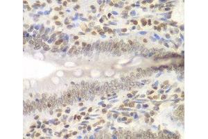 Immunohistochemistry of paraffin-embedded Rat Intestine using UHRF2 Polyclonal Antibody at dilution of 1:200 (40x lens). (UHRF2 抗体)