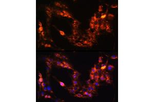 Immunofluorescence analysis of C6 cells using GRM1 Rabbit pAb  at dilution of 1:100 (40x lens). (Metabotropic Glutamate Receptor 1 抗体  (AA 921-1010))