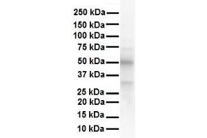 Western Blotting (WB) image for anti-Estrogen Receptor 2 (ESR2) (N-Term) antibody (ABIN2776499)
