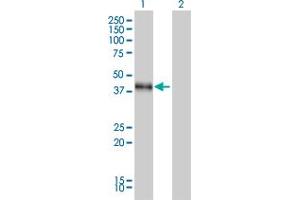 Western Blot analysis of DLX3 expression in transfected 293T cell line by DLX3 monoclonal antibody (M01), clone 4F8. (DLX3 抗体  (AA 1-287))