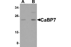 Western Blotting (WB) image for anti-Calcium Binding Protein 7 (CABP7) (N-Term) antibody (ABIN1031287) (CABP7 抗体  (N-Term))