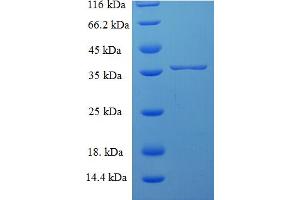 Sorting Nexin 24 (SNX24) (AA 1-169), (full length) protein (His-SUMO Tag)