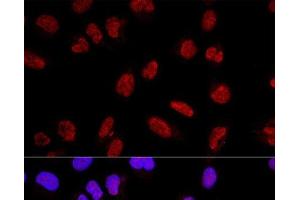 Confocal immunofluorescence analysis of U2OS cells using AKAP8 Polyclonal Antibody at dilution of 1:200. (AKAP8 抗体)