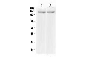 Western blot analysis of MED14 using anti-MED14 antibody . (MED14 抗体  (AA 181-375))