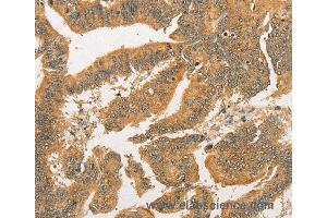 Immunohistochemistry of Human tonsil using BCL2L14 Polyclonal Antibody at dilution of 1:40 (BCL2L14 抗体)