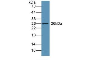 Detection of Recombinant RBP3, Rat using Polyclonal Antibody to Retinol Binding Protein 3, Interstitial (RBP3) (RBP3 抗体  (AA 1027-1229))