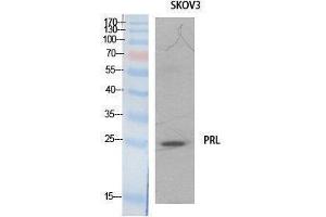 Western Blotting (WB) image for anti-Prolactin (PRL) (Internal Region) antibody (ABIN3181064) (Prolactin 抗体  (Internal Region))