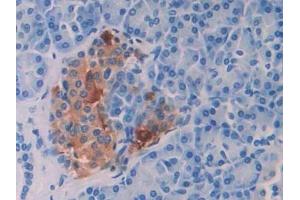Detection of ENA78 in Human Pancreas Tissue using Polyclonal Antibody to Epithelial Neutrophil Activating Peptide 78 (ENA78) (CXCL5 抗体  (AA 38-114))