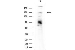 anti-BMS1 Homolog, Ribosome Assembly Protein (BMS1) (C-Term) antibody