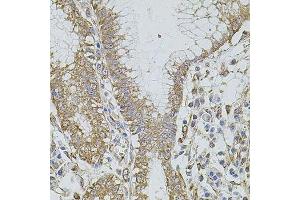 Immunohistochemistry (Paraffin-embedded Sections) (IHC (p)) image for anti-Hyaluronan-Mediated Motility Receptor (RHAMM) (HMMR) (AA 341-440) antibody (ABIN3016223)