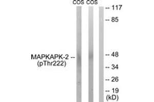 Western blot analysis of extracts from COS7 cells treated with UV 15', using MAPKAPK-2 (Phospho-Thr222) Antibody. (MAPKAP Kinase 2 抗体  (pThr222))