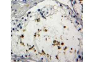 IHC-P analysis of Testis tissue, with DAB staining. (FOXP1 抗体  (AA 461-671))