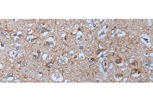 Immunohistochemistry of paraffin-embedded Human brain tissue using YPEL5 Polyclonal Antibody at dilution of 1:60(x200) (YPEL5 抗体)