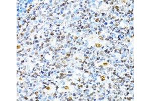 Immunohistochemistry of paraffin-embedded Human appendix using XRCC4 Polyclonal Antibody at dilution of 1:100 (40x lens). (XRCC4 抗体)