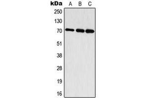 Western blot analysis of S6K1 (pT444) expression in HepG2 EGF-treated (A), mouse brain (B), rat brain (C) whole cell lysates. (RPS6KB1 抗体  (C-Term, pSer444))