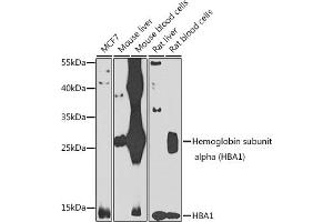 Western blot analysis of extracts of various cell lines, using Hemoglobin subunit alpha (Hemoglobin subunit alpha (HB)) antibody (ABIN6128046, ABIN6141635, ABIN6141636 and ABIN6223164) at 1:1000 dilution. (HBA1 抗体  (AA 1-142))