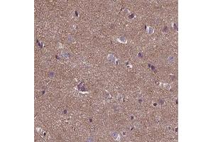 ABIN6266756 at 1/100 staining human brain tissue sections by IHC-P. (ANKRD26 抗体  (Internal Region))