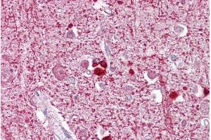 Immunohistochemistry with Brain, cortex tissue at an antibody concentration of 5µg/ml using anti-ZEB2 antibody (ARP33695_P050) (ZEB2 抗体  (N-Term))