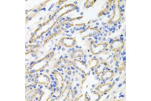 Immunohistochemistry of paraffin-embedded mouse kidney using IRAK2 antibody. (IRAK2 抗体)