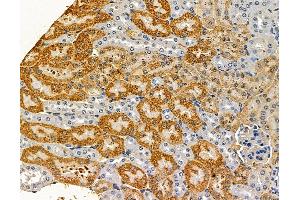 ABIN7096825 and ABIN7100891 at 1/100 staining mouse kidney tissue by IHC-P. (CRISP1 抗体)