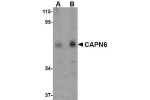 Western blot analysis of CAPN6 in rat lung tissue lysate with AP30177PU-N CAPN6 antibody at (A) 0. (Calpain 6 抗体  (C-Term))
