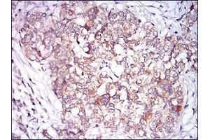 Immunohistochemistry (IHC) image for anti-Calcium/calmodulin-Dependent Protein Kinase II gamma (CAMK2G) (AA 322-481) antibody (ABIN2682978)