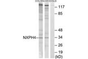 Western blot analysis of extracts from COLO/HuvEc cells, using NXPH4 Antibody. (Neurexophilin 4 抗体  (AA 216-265))