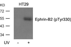 Western blot analysis of extracts from HT29 cells, untreated or treated with UV using Ephrin-B2(Phospho-Tyr330) Antibody. (Ephrin B2 抗体  (pTyr330))