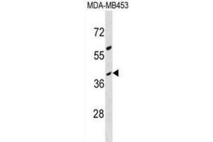 Western Blotting (WB) image for anti-Olfactory Receptor, Family 10, Subfamily G, Member 8 (OR10G8) antibody (ABIN3000509) (OR10G8 抗体)