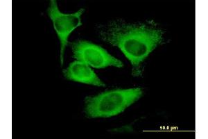 Immunofluorescence of monoclonal antibody to EIF5 on HeLa cell. (EIF5 抗体  (AA 1-431))