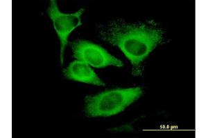 Immunofluorescence of monoclonal antibody to EIF5 on HeLa cell.