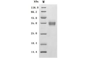 (Tris-Glycine gel) Discontinuous SDS-PAGE (reduced) with 5 % enrichment gel and 15 % separation gel.