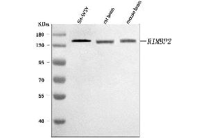 Western blot analysis of RIMBP2 using anti-RIMBP2 antibody (ABIN7601441). (RIMBP2 抗体  (AA 351-1049))