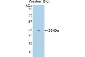 Detection of Recombinant HIF2a, Human using Polyclonal Antibody to Hypoxia Inducible Factor 2 Alpha (HIF2a) (EPAS1 抗体  (AA 339-541))