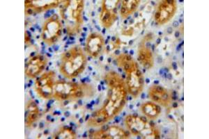 Used in DAB staining on fromalin fixed paraffin-embedded kidney tissue (Profilin 3 抗体  (AA 1-133))