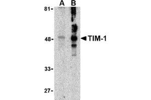 Western blot analysis of TIM-1 in human uterus tissue lysate with this product at (A) 1 and (B) 2 μg/ml. (HAVCR1 抗体  (N-Term))